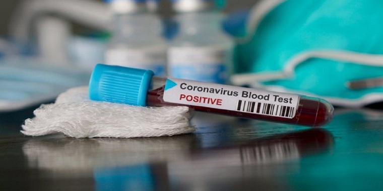 Zimbabwe has no coronavirus death for two days running